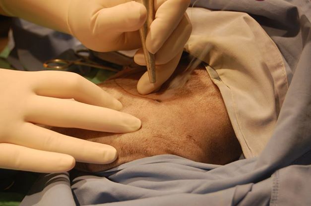 Laser Therapy & Surgery
